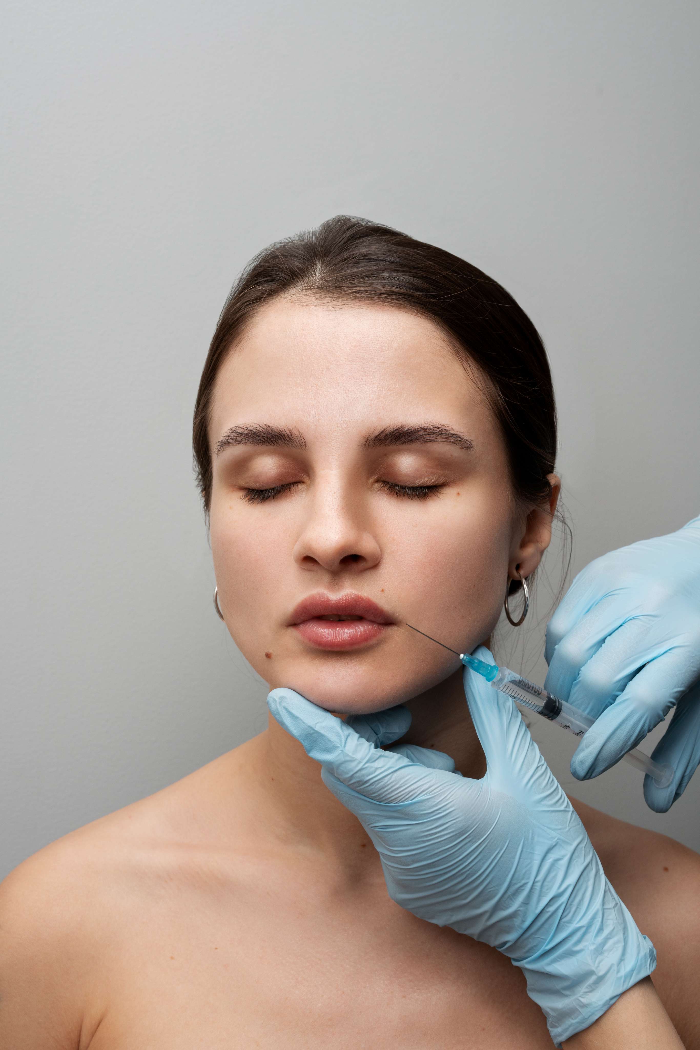 Lip Fillers